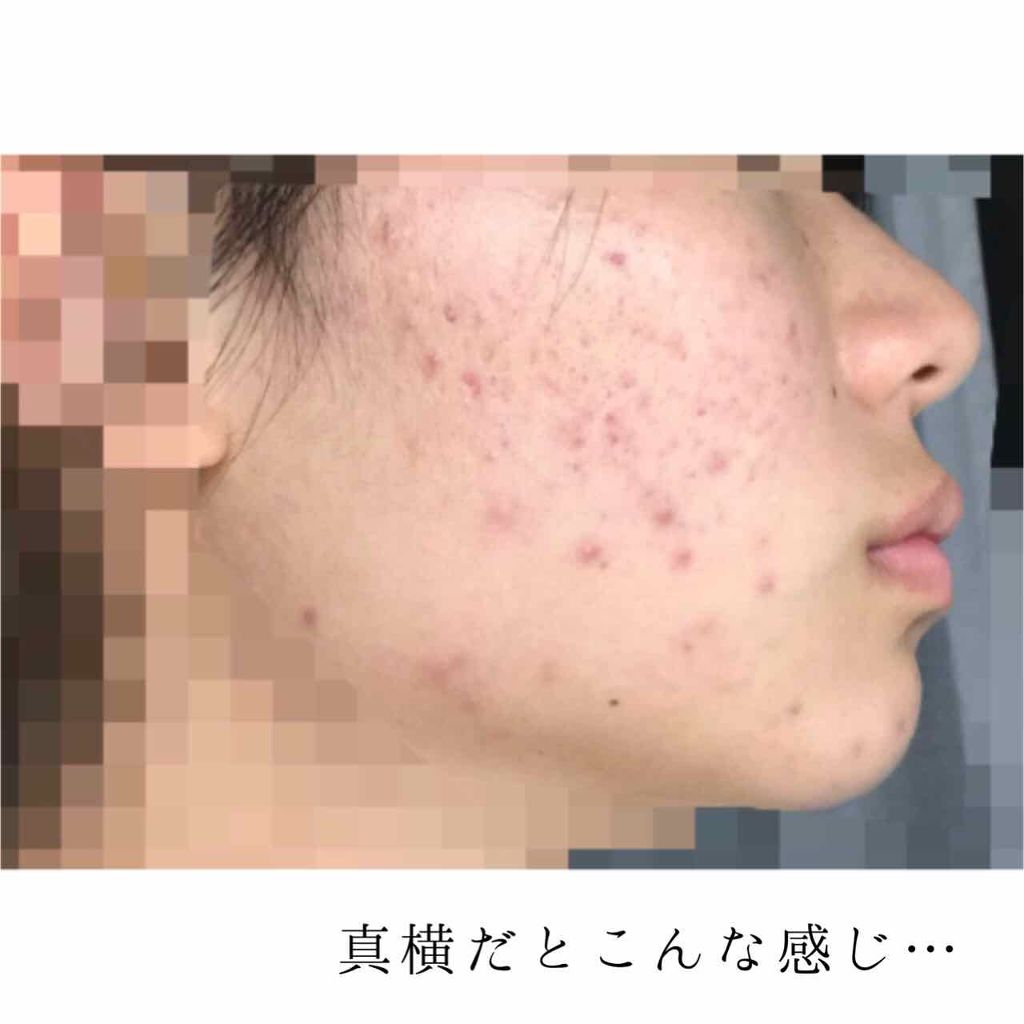 ハトムギ化粧水(ナチュリエ スキンコンディショナー R )/ナチュリエ/化粧水を使ったクチコミ(3枚目)