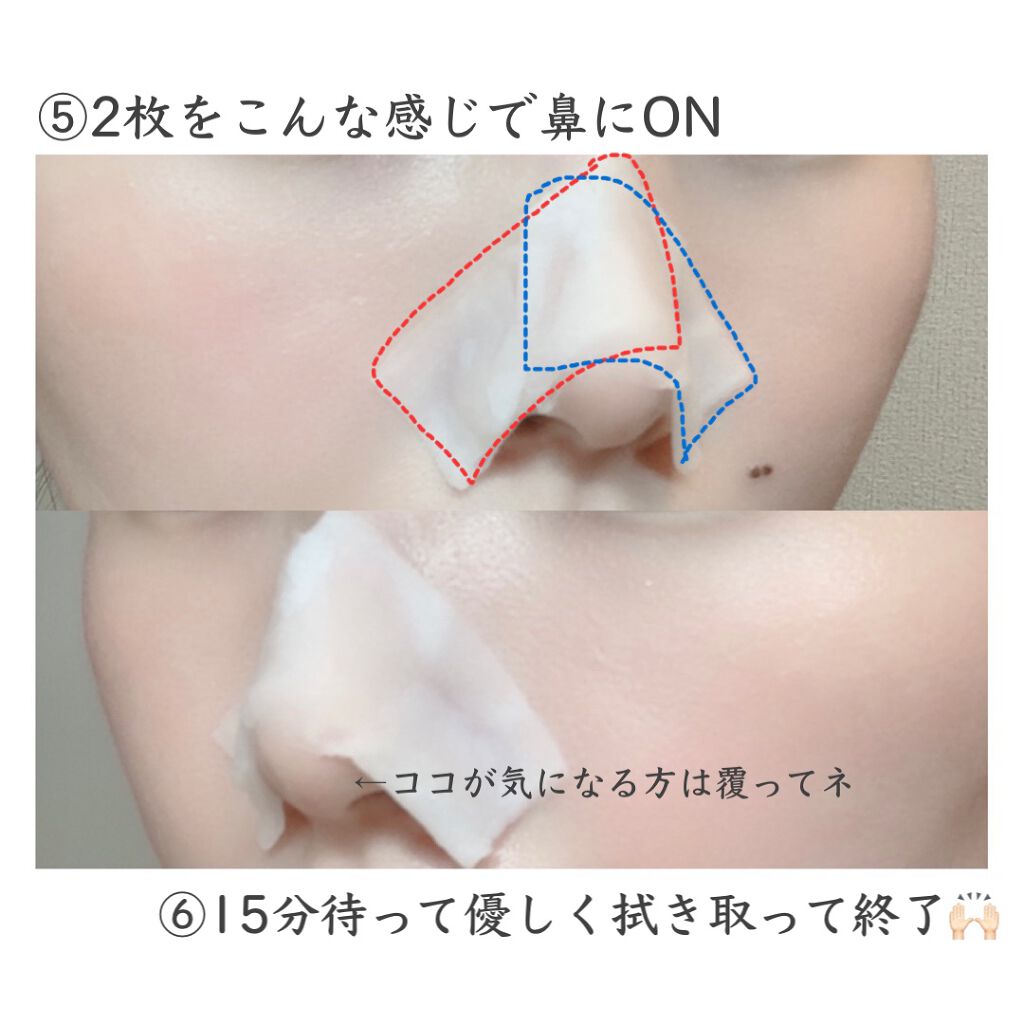 ノーモアブラックヘッド(ノーズピーリング)/One-day's you/スクラブ・ゴマージュを使ったクチコミ(4枚目)