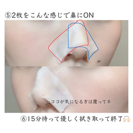 ノーモアブラックヘッド(ノーズピーリング)/One-day's you/スクラブ・ゴマージュを使ったクチコミ(4枚目)