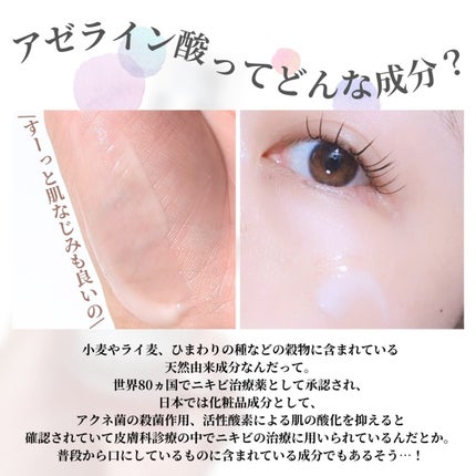 アゼペア 美容液/ネイチャーリパブリック/美容液を使ったクチコミ(4枚目)