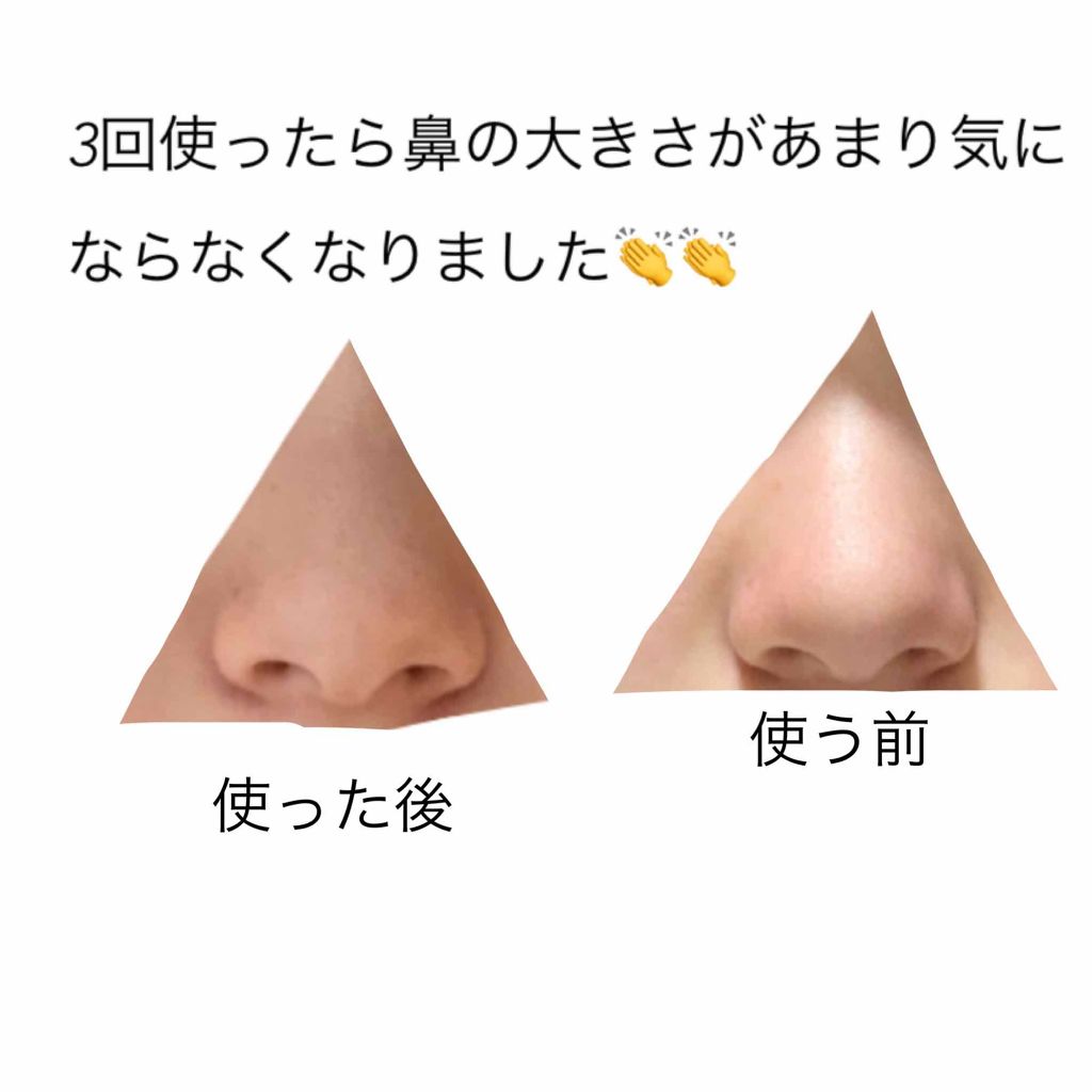 ノーズトレーナー Daisoの使い方を徹底解説 超優秀 100均で買えるおすすめスキンケアグッズ Daisoのノーズ By すずか 普通肌 10代後半 Lips ノーズトレーナー Daisoの使い方を徹底解説 超優秀 100均で買えるおすすめスキンケアグッズ Daisoのノーズ By すずか 普通肌 10代後半 Lips