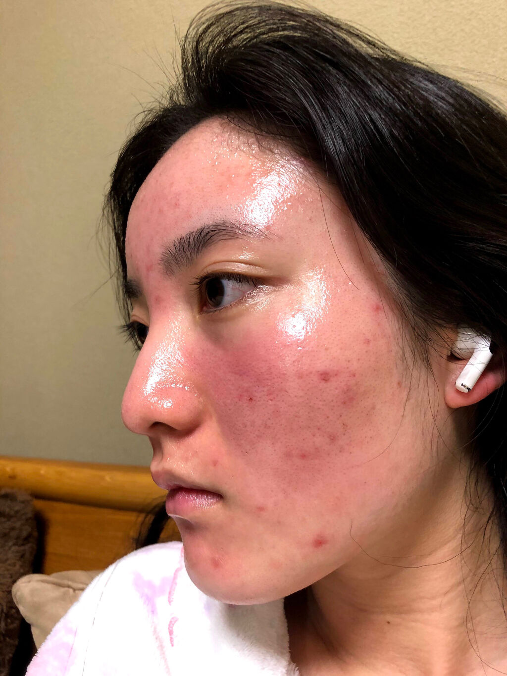 ハトムギオールインワンジェル/ハトムギ健康美人シリーズ/オールインワン化粧品を使ったクチコミ（2枚目）