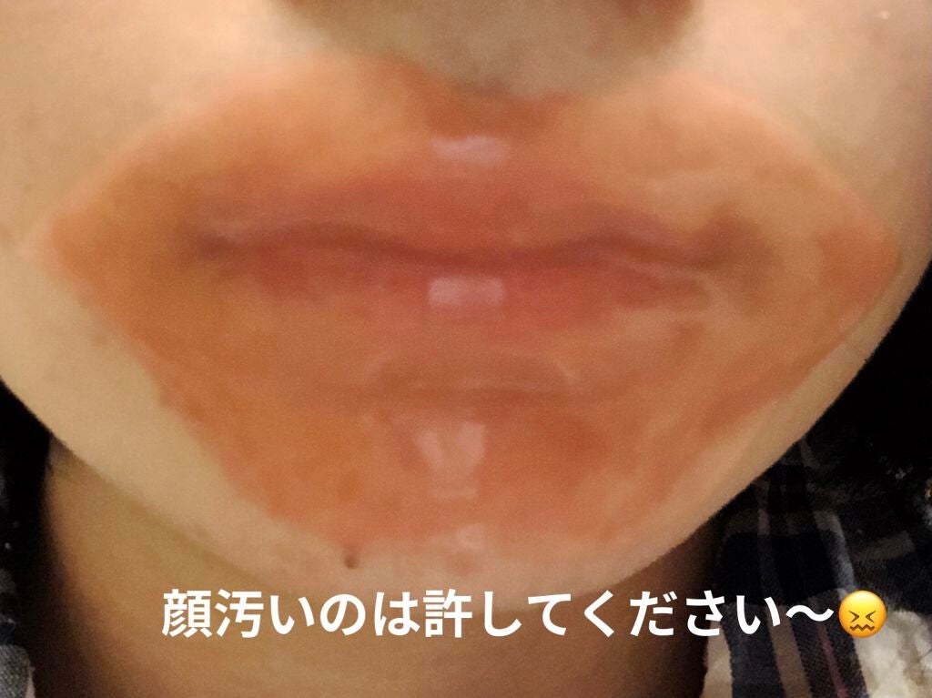 リップパック /CHOOSY/リップマスクを使ったクチコミ(2枚目)