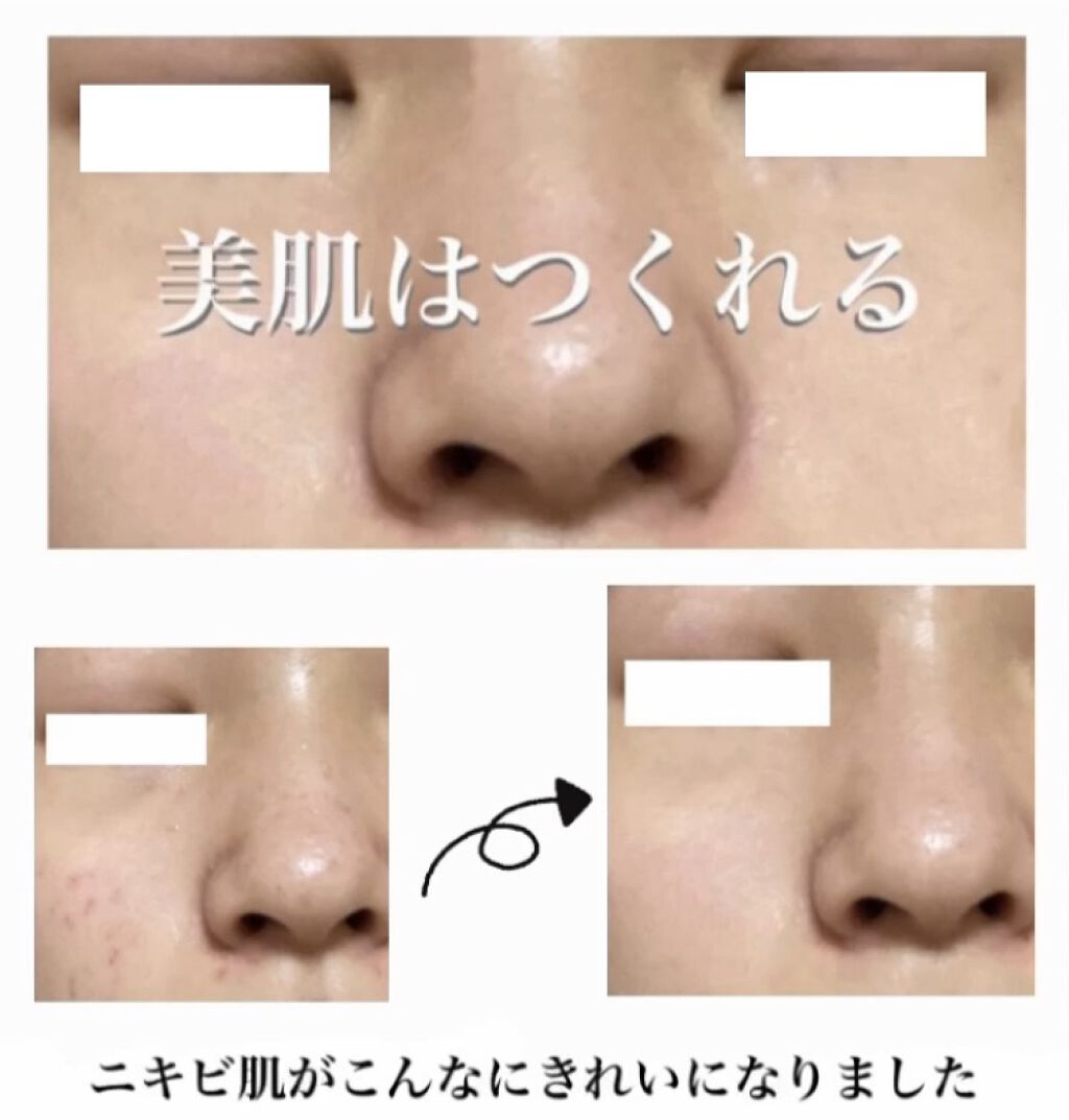 ロゼット洗顔パスタ 海泥スムース/ロゼット/洗顔フォームを使ったクチコミ（1枚目）