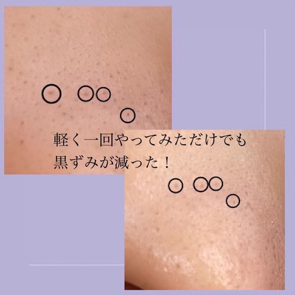 ブラックヘッドクリア2ステップノーズパッチ/DPU/シートマスク・パックを使ったクチコミ(3枚目)