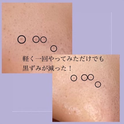 クリーン&クリアクレンジングオイル/DPU/オイルクレンジングを使ったクチコミ(3枚目)