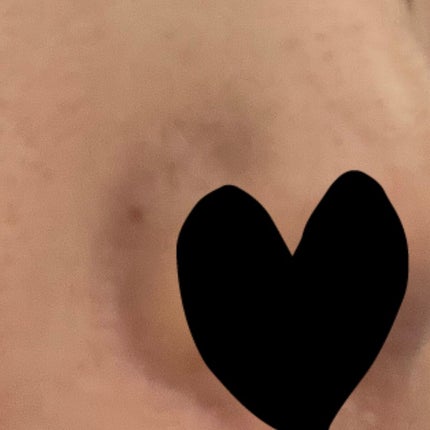 毛穴小町 ブラックピールオフパック/クリアターン/ピーリングを使ったクチコミ(1枚目)