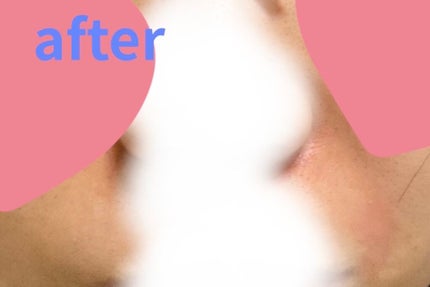 トリートメントアイシート/THE STEM CELL/シートマスク・パックを使ったクチコミ(6枚目)