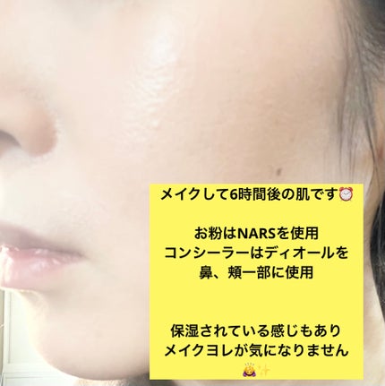 ウォンジョンヨ モイストアップレディスキンパック N/Wonjungyo/シートマスク・パックを使ったクチコミ(4枚目)