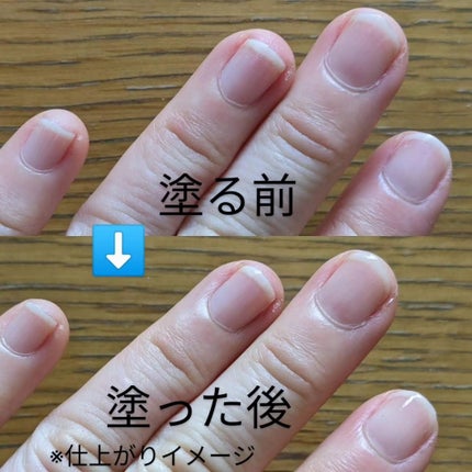 自爪コート/ネイリスト/オールインワンネイルを使ったクチコミ(6枚目)