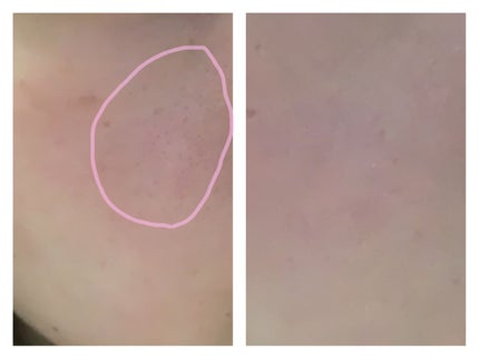 フィットミー リキッドファンデーション R 109/MAYBELLINE NEW YORK/リキッドファンデーションを使ったクチコミ(2枚目)