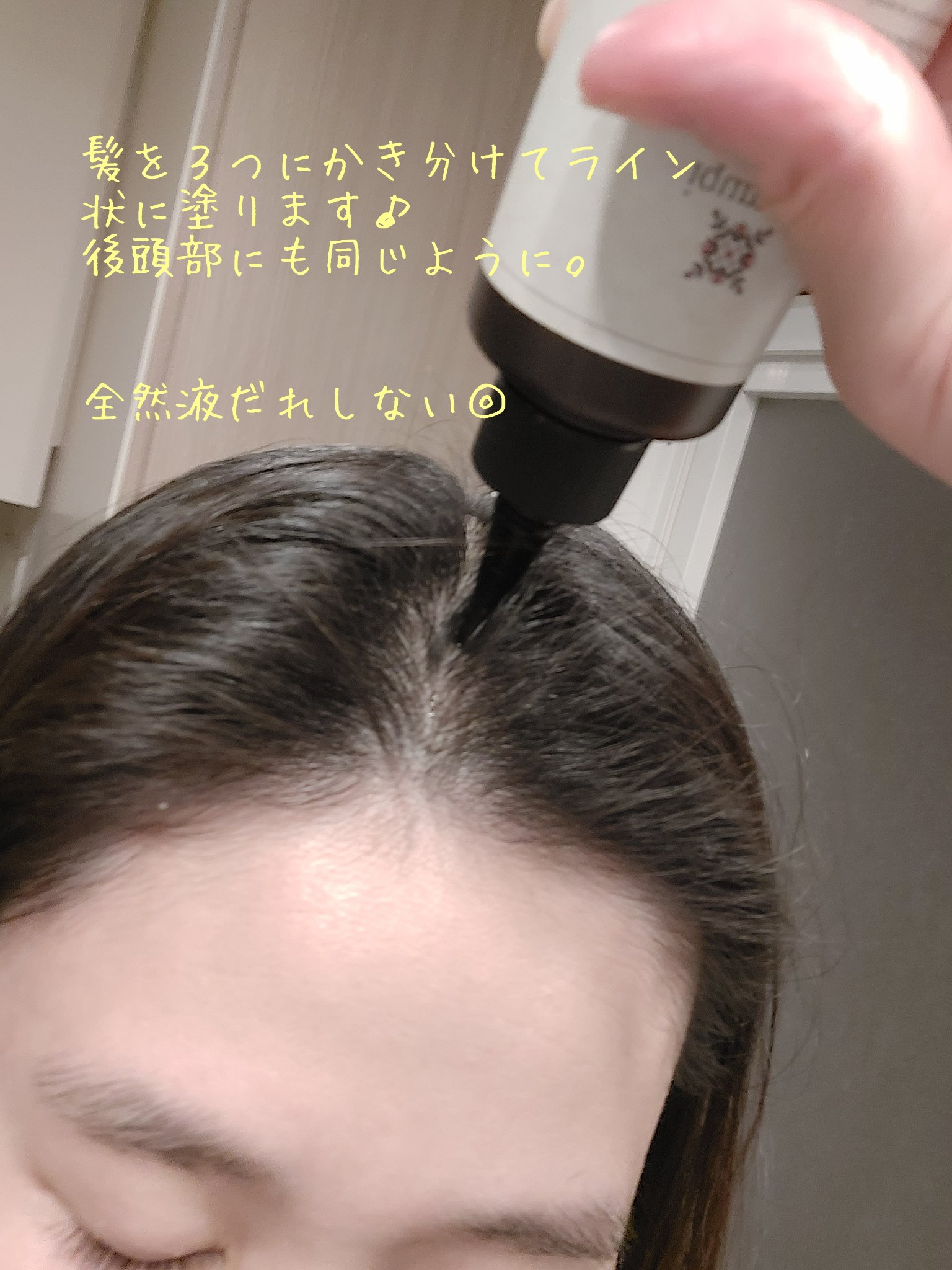 ナノグロウリッチ/iqumore/頭皮ローションを使ったクチコミ（3枚目）