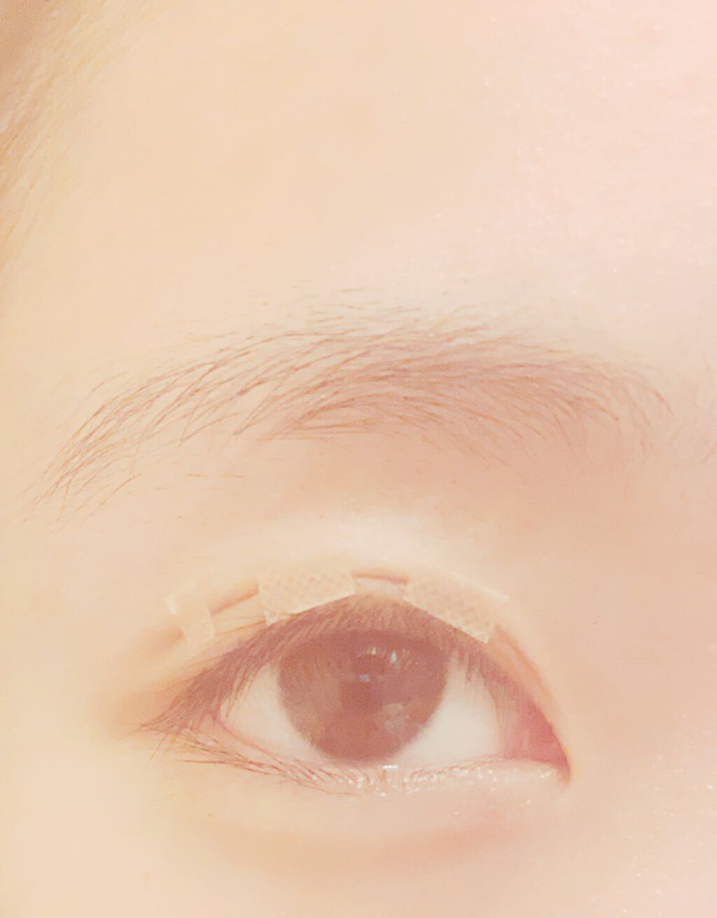 肌色タイプ/バンドエイド/その他を使ったクチコミ(3枚目)