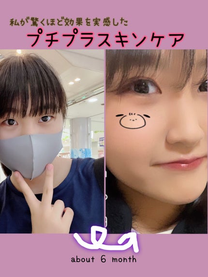 リアルカロテンブレミッシュクリアセラム/APRILSKIN/美容液を使ったクチコミ(1枚目)