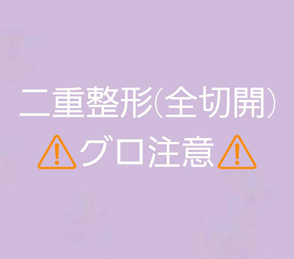 二重整形/その他を使ったクチコミ（1枚目）