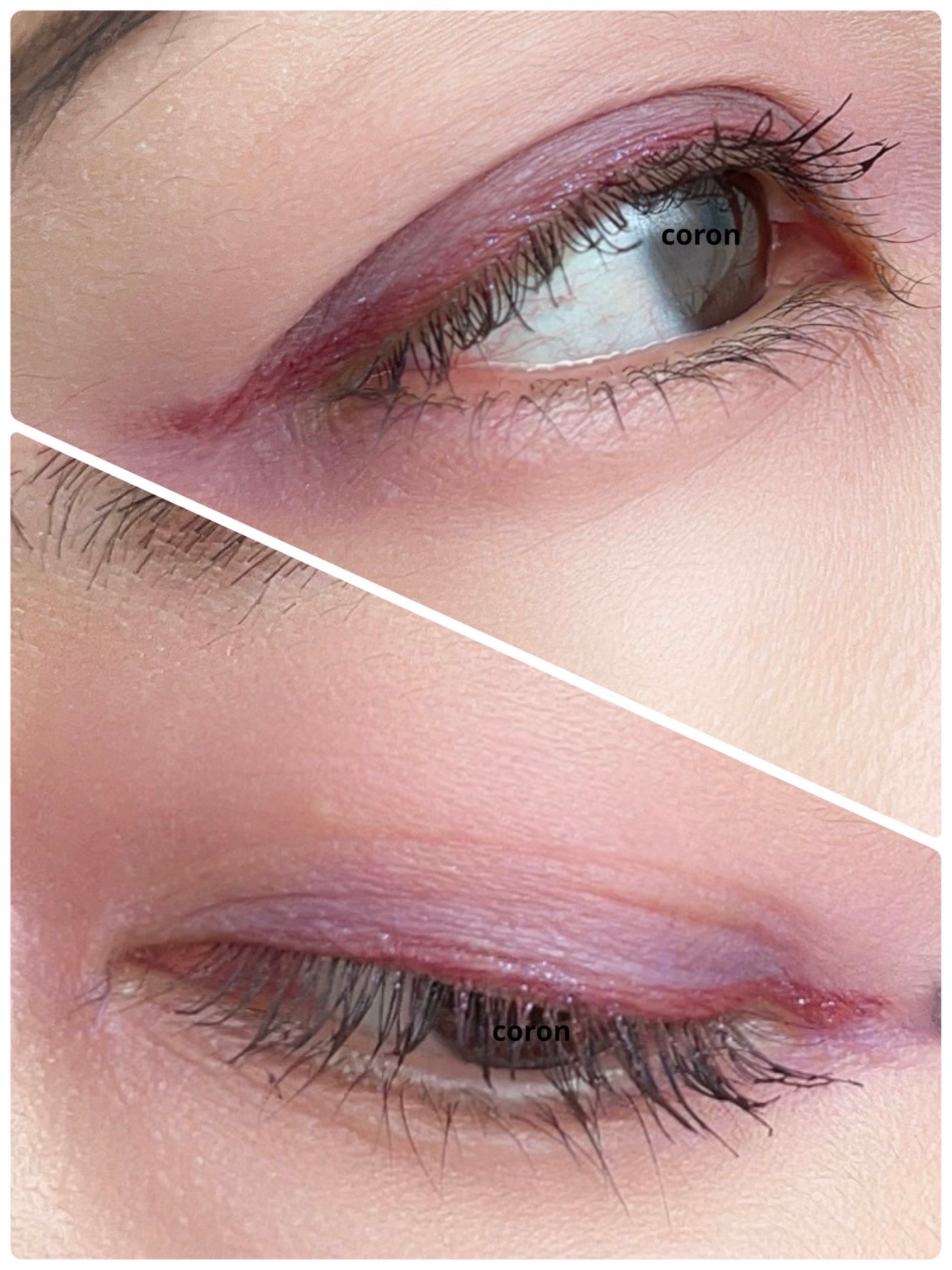 ããŒãã§ã¯ããšã¯ã¹ãã³ã·ã§ã³ ãã¹ã«ã©/D-UP/ãã¹ã«ã©ã䜿ã£ãã¯ãã³ãïŒ2æç®ïŒ