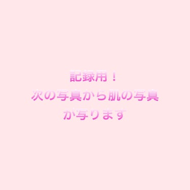 VT シカレチA クリーム0.05のクチコミ「記録用

すごく肌荒れしてしまったので，レチノールに挑戦します！

今回は一回も使用していない.....」（1枚目）