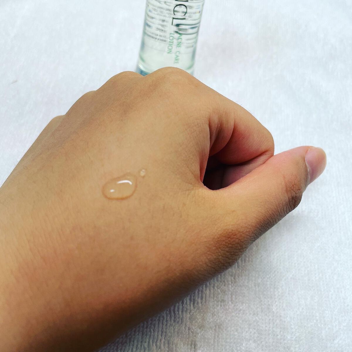 アクネケア 化粧液　＜医薬部外品＞/ファンケル/化粧水 by marin