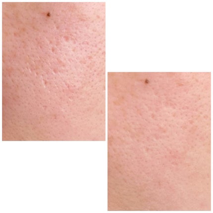 オイルブロックミネラルパウダー/キャンメイク/ルースパウダーを使ったクチコミ(4枚目)