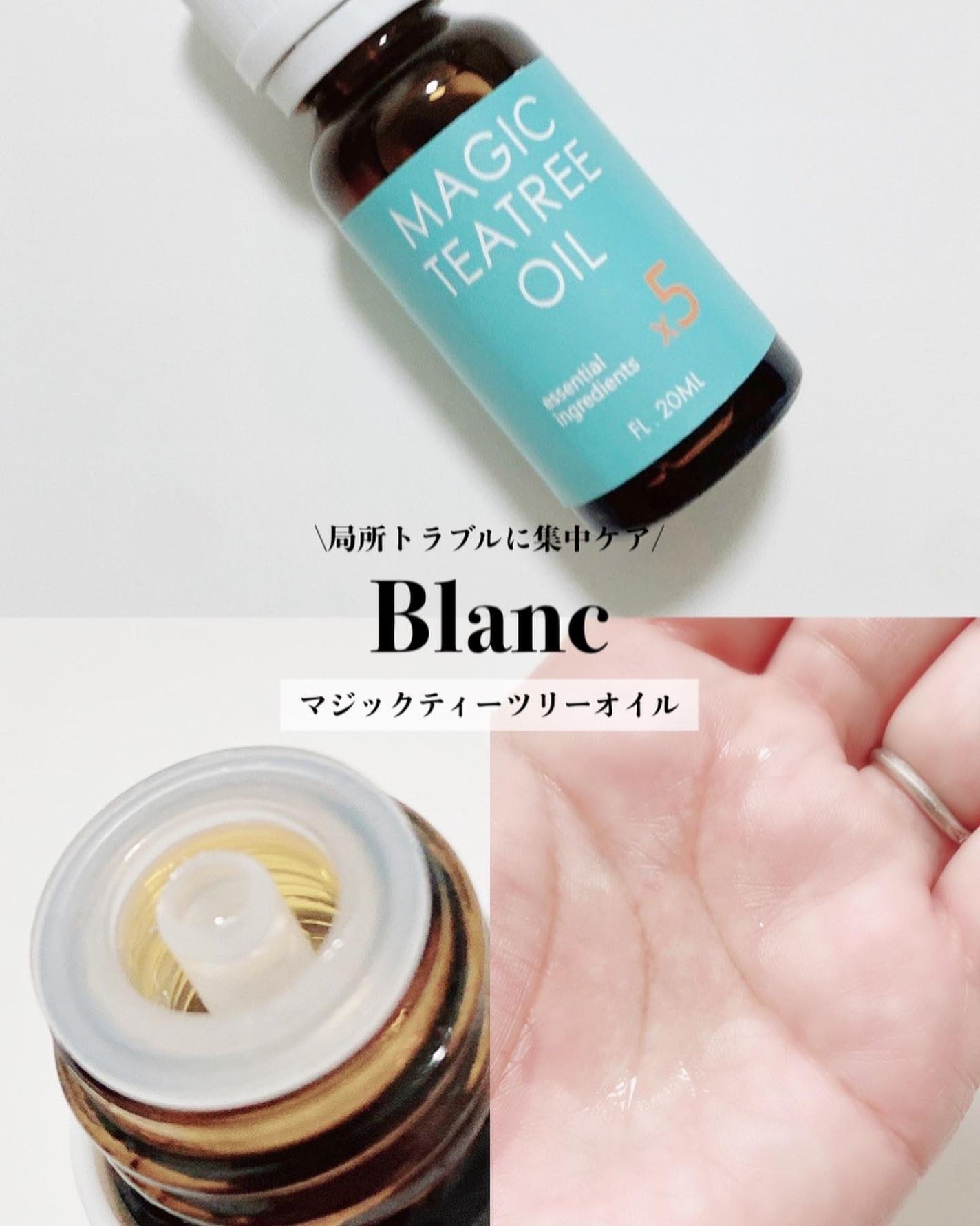 マジックティーツリーオイル/ブラン/フェイスオイルを使ったクチコミ(1枚目)