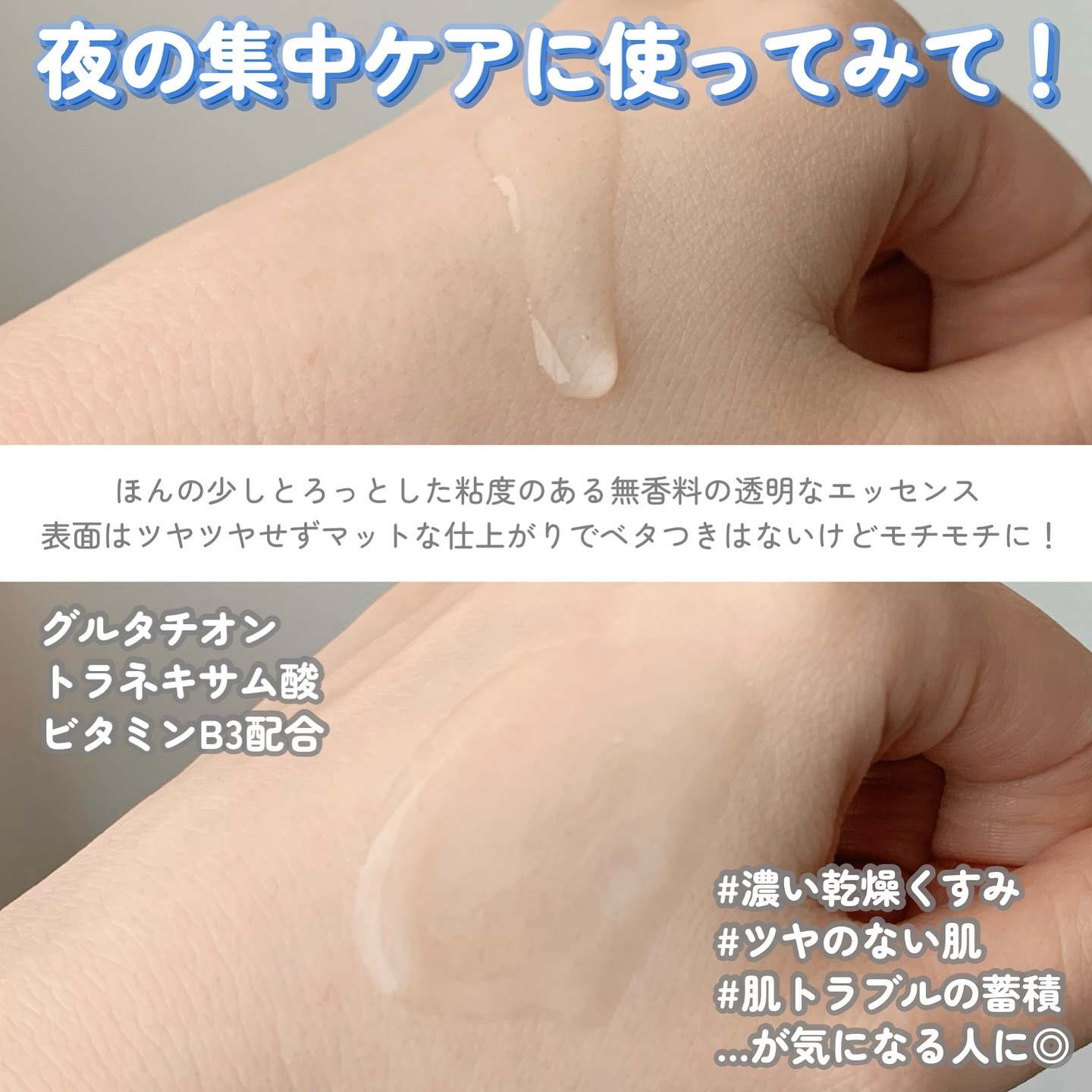 TXトーニングエッセンス2000/VT/美容液を使ったクチコミ（2枚目）