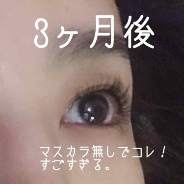 Enhancements Lash Boost Rodan And Fieldsの使い方を徹底解説 日本未発売のまつ毛美容液rodan Fie By さくらん 乾燥肌 40代前半 Lips