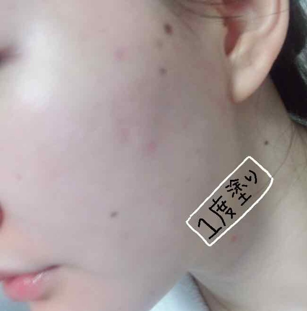 マイクロセッティングフィットEX SPF50+PA++++ Micro setting fit Cushion EX/moonshot/クッションファンデーションを使ったクチコミ(3枚目)