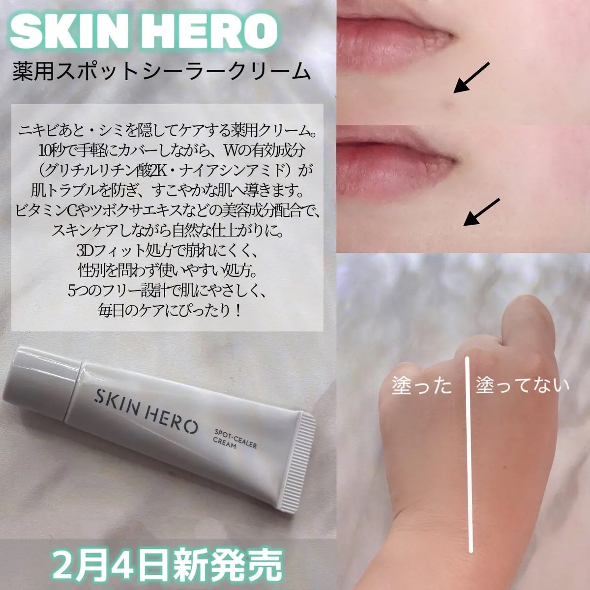 薬用スポットシーラークリーム/スキンヒーロー/クリームコンシーラーを使ったクチコミ（2枚目）
