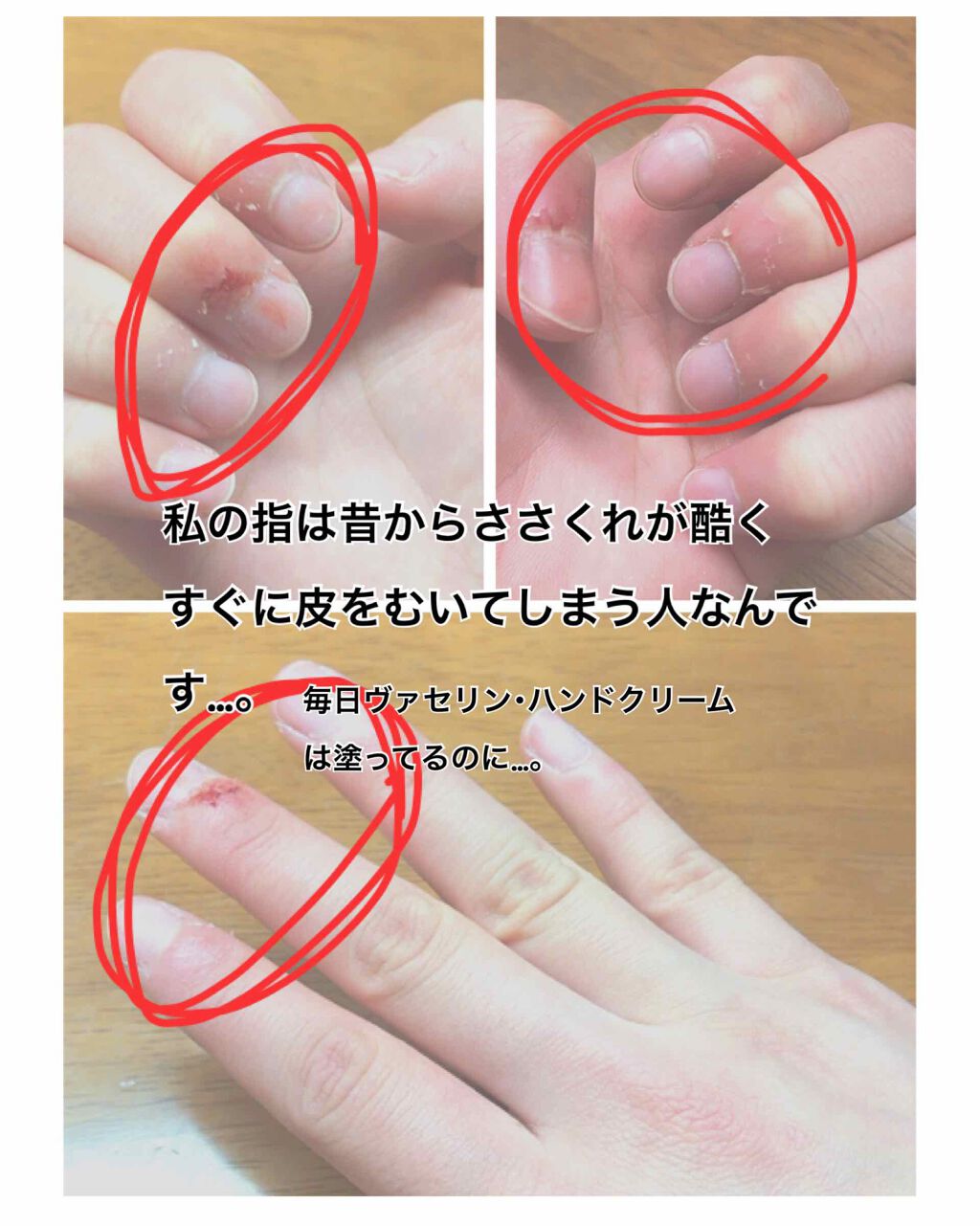 ニベアクリーム/ニベア/ボディクリームを使ったクチコミ(2枚目)