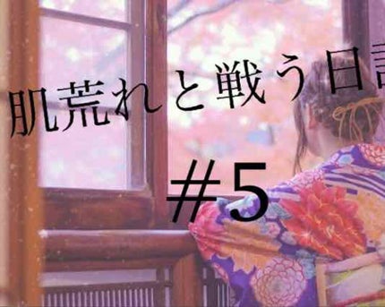 薬用保湿化粧水/オードムーゲ/化粧水を使ったクチコミ(1枚目)
