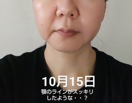 オバジX リフトローション/オバジ/化粧水を使ったクチコミ(3枚目)