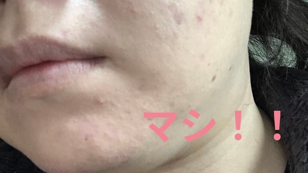 24 ミネラルUVコンシーラー/24h cosme/パレットコンシーラーを使ったクチコミ(5枚目)