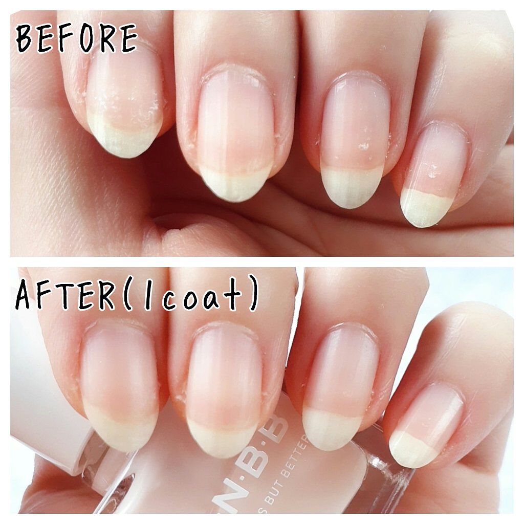 パーフェクトネイルコート/M･N･B･B/オールインワンネイルを使ったクチコミ（3枚目）