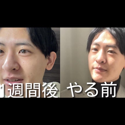 テラスキン/LINE REPAIR/美容液を使ったクチコミ(4枚目)