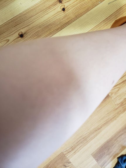 脱毛テープ/エピラット/除毛クリームを使ったクチコミ(4枚目)