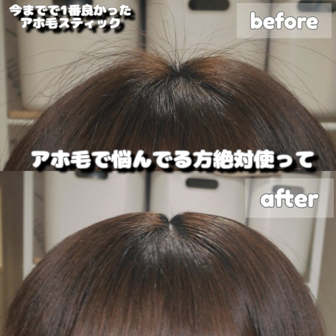 エルジューダ  ポイントケアスティック/エルジューダ/ヘアジェルを使ったクチコミ（1枚目）