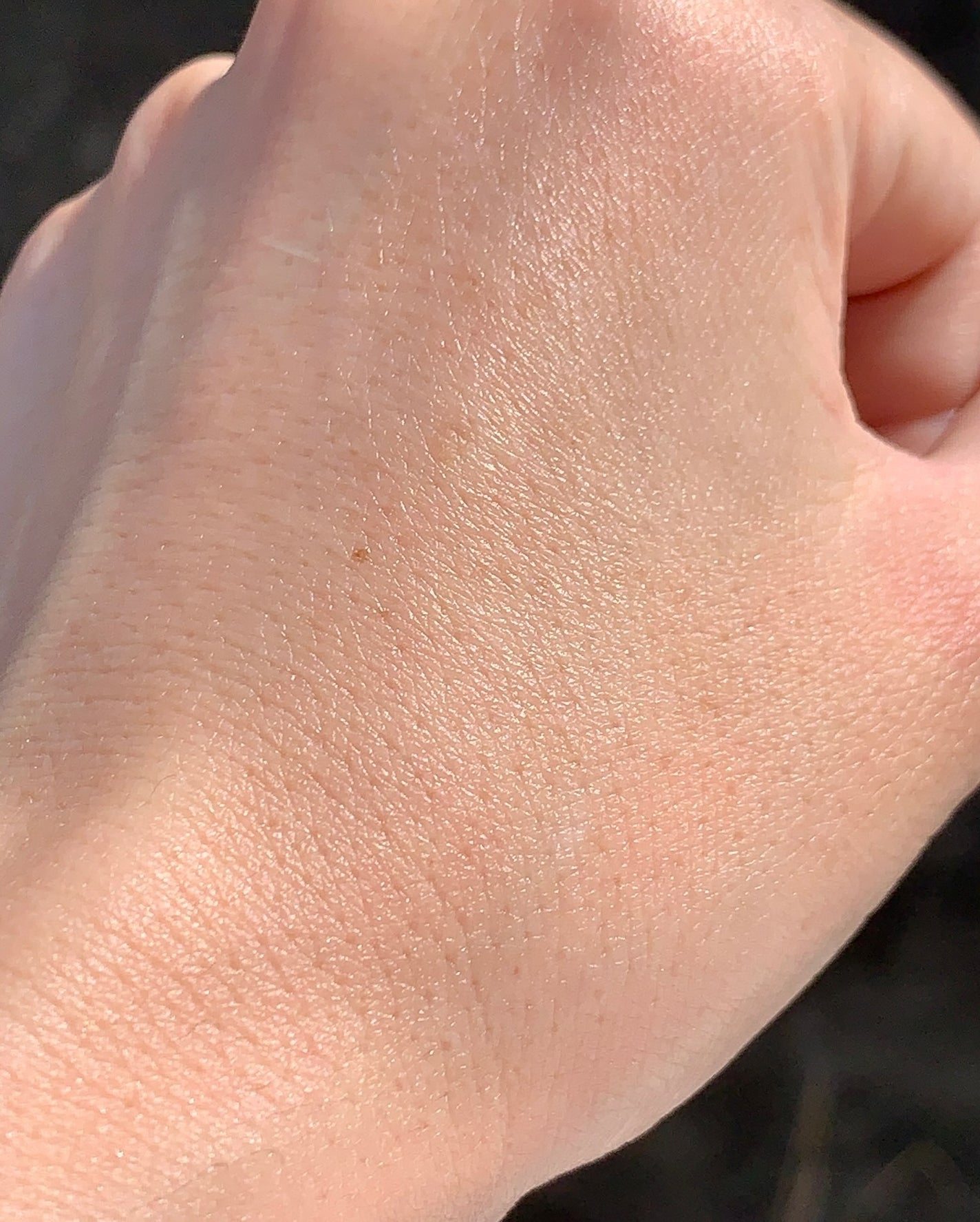 薬用メラノシグナルエッセンス/トランシーノ/美容液を使ったクチコミ(7枚目)