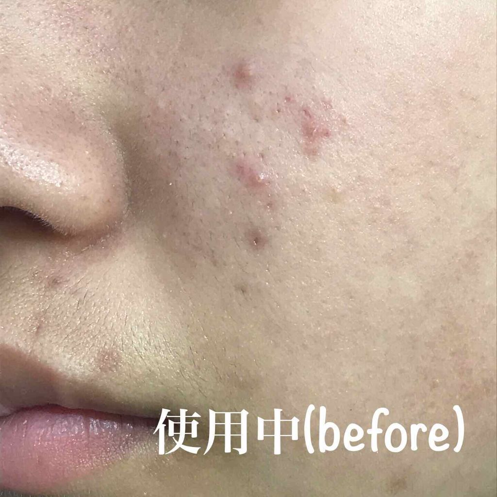 ロゼット 洗顔パスタ　荒性肌/ロゼット/洗顔フォームを使ったクチコミ（3枚目）