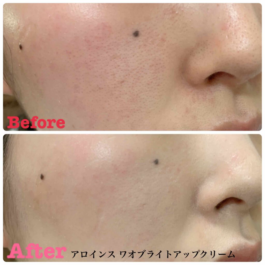 ブライトアップクリーム/ワオ/フェイスクリームを使ったクチコミ(4枚目)
