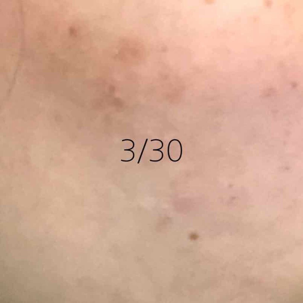 明色美顔水 薬用化粧水/美顔/化粧水を使ったクチコミ（3枚目）