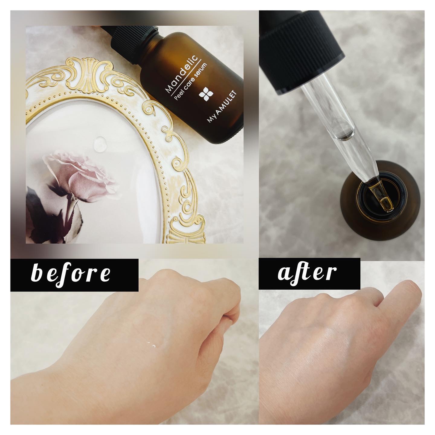 ピールケアセラム/My AMULET/美容液を使ったクチコミ（2枚目）