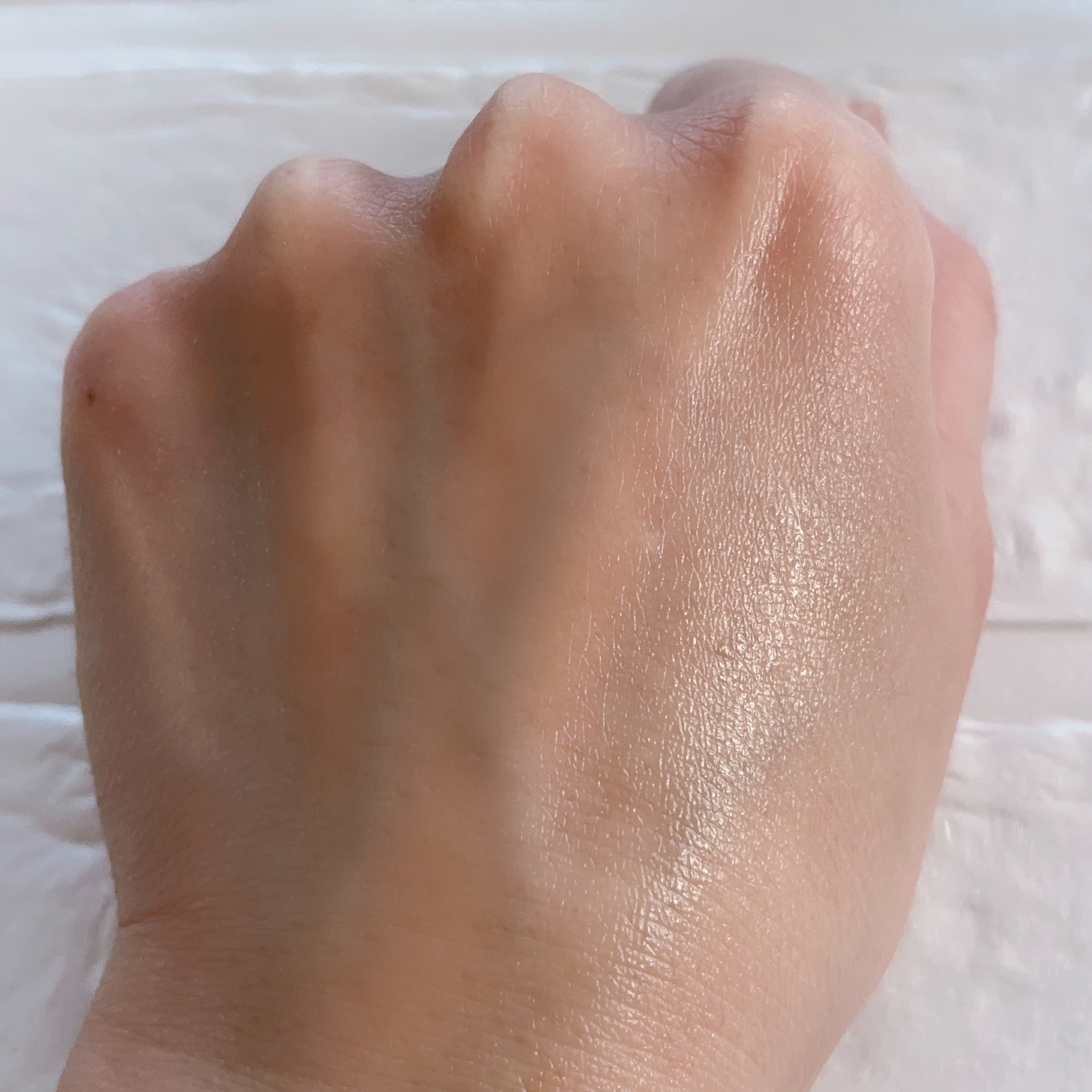 fractionalCC ニードルセラムC/fractionalCC/美容液を使ったクチコミ（3枚目）