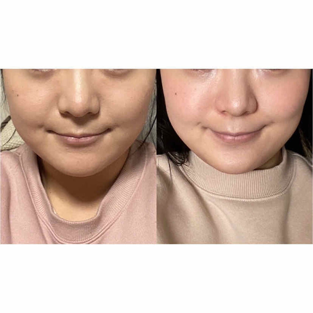 ïœïœïœð° on LIPS ãBeforeAfterãåããã¥ãããŠç³ãèš³ãããŸãããåçã¯..ãïŒ2æç®ïŒ