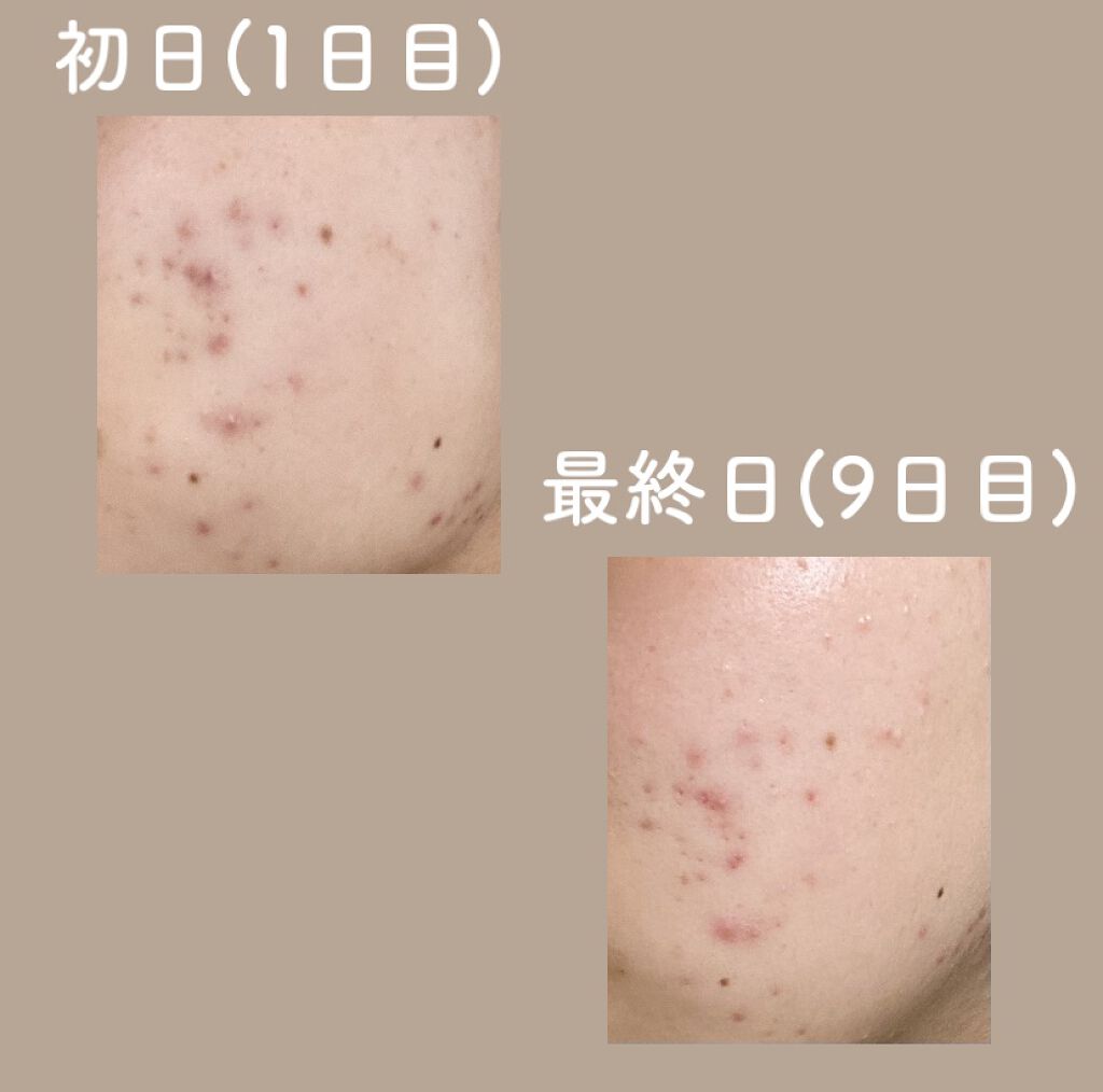 エリクシール ルフレ バランシング ウォーター II/エリクシール/化粧水を使ったクチコミ（2枚目）