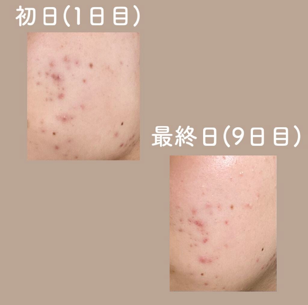 ハトムギ保湿ジェル(ナチュリエ スキンコンディショニングジェル)/ナチュリエ/美容液を使ったクチコミ(2枚目)