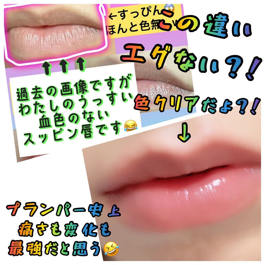 ドトムリッププラスプランパー/keybo/リッププランパーを使ったクチコミ(2枚目)