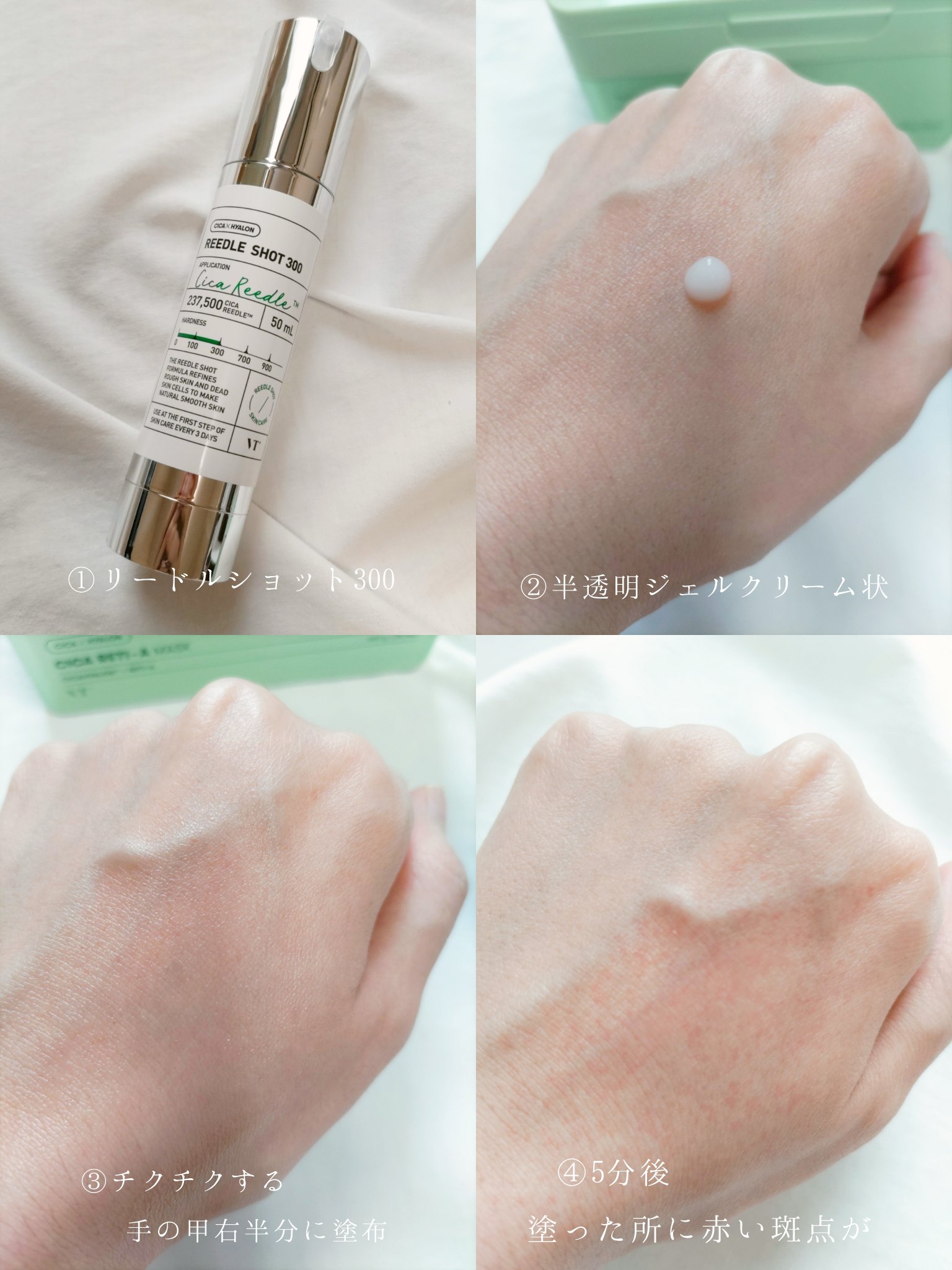 シカレチA エッセンス0.1/VT/美容液を使ったクチコミ（2枚目）