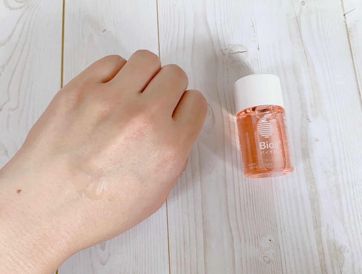 バイオイル/バイオイル/フェイスオイルを使ったクチコミ(4枚目)