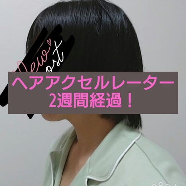 はな🌼です。

ヘアアクセルレーターを使用してから2週間経ちました。
2枚目と3枚目を比べると、少し伸びてるのがわかります。

当たり前ですが、魔法みたいにギュンギュン伸びることはありません。

でも何