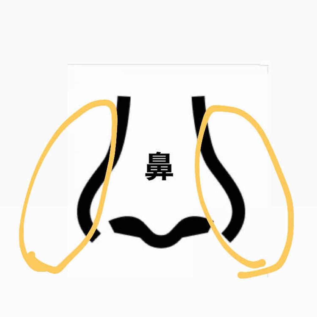 オードムーゲ 薬用ローション(ふきとり化粧水)/オードムーゲ/拭き取り化粧水を使ったクチコミ(2枚目)